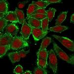 Moesin Antibody in Immunocytochemistry (ICC/IF)