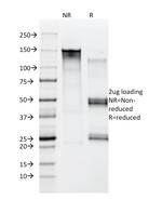 Moesin Antibody in SDS-PAGE (SDS-PAGE)