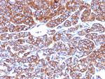 Moesin Antibody in Immunohistochemistry (Paraffin) (IHC (P))