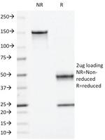 Moesin Antibody in SDS-PAGE (SDS-PAGE)