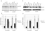 Phospho-EGFR (Tyr845) Antibody in Western Blot (WB)