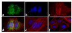 Phospho-EGFR (Tyr845) Antibody