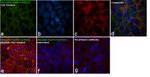 Phospho-EGFR (Tyr992) Antibody