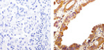 Phospho-EGFR (Tyr992) Antibody in Immunohistochemistry (Paraffin) (IHC (P))