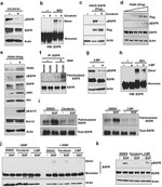 Phospho-EGFR (Tyr1173) Antibody in Western Blot (WB)