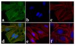 Phospho-EGFR (Tyr1173) Antibody in Immunocytochemistry (ICC/IF)