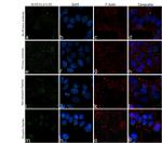 Phospho-IR/IGF1R (Tyr1158) Antibody in Immunocytochemistry (ICC/IF)