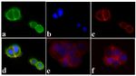 Phospho-IR/IGF1R (Tyr1162, Tyr1163) Antibody