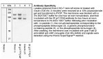 Phospho-INSR (Tyr1334) Antibody in Western Blot (WB)