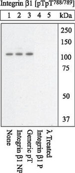 Phospho-ITGB1 (Thr788, Thr789) Antibody in Western Blot (WB)