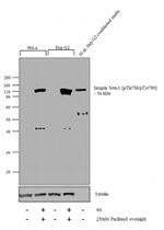 Phospho-ITGB1 (Thr788, Thr789) Antibody in Western Blot (WB)