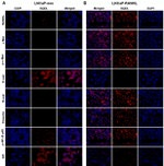 Phospho-c-Met (Tyr1230, Tyr1234, Tyr1235) Antibody in Immunohistochemistry (IHC)