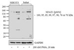 Phospho-NFATC2 (Ser54) Antibody in Western Blot (WB)