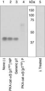 Phospho-PKA alpha/beta (Thr197) Antibody in Western Blot (WB)