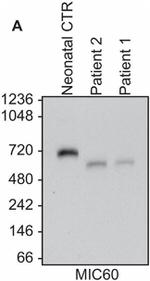 Mitofilin Antibody in Western Blot (WB)