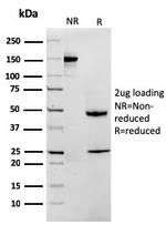 MTAP Antibody in SDS-PAGE (SDS-PAGE)