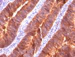 MUC1/CA15-3/EMA/CD227 (Epithelial Marker) Antibody in Immunohistochemistry (Paraffin) (IHC (P))