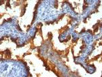 MUC1/CA15-3/EMA/CD227 (Epithelial Marker) Antibody in Immunohistochemistry (Paraffin) (IHC (P))