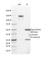 MUC2 (Mucin 2) Antibody in SDS-PAGE (SDS-PAGE)