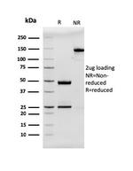 MUC2 (Mucin 2) Antibody in SDS-PAGE (SDS-PAGE)