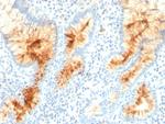 MUC4 (Mucin 4/Gastric Mucin) Antibody in Immunohistochemistry (Paraffin) (IHC (P))