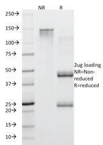 MUC5AC (Mucin 5AC/Gastric Mucin) Antibody in SDS-PAGE (SDS-PAGE)