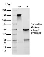 MUC5AC (Mucin 5AC/Gastric Mucin) Antibody in SDS-PAGE (SDS-PAGE)