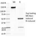 MUC5AC (Mucin 5AC/Gastric Mucin) Antibody in SDS-PAGE (SDS-PAGE)