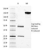 MUC5AC (Mucin 5AC/Gastric Mucin) Antibody in SDS-PAGE (SDS-PAGE)