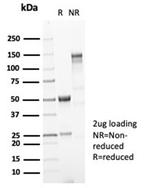 MUC5AC (Mucin 5AC/Gastric Mucin) Antibody in SDS-PAGE (SDS-PAGE)