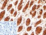 MUC5AC (Mucin 5AC/Gastric Mucin) Antibody in Immunohistochemistry (Paraffin) (IHC (P))