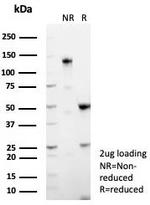 MUC5AC (Mucin 5AC/Gastric Mucin) Antibody in Immunohistochemistry (Paraffin) (IHC (P))