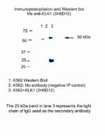 ELK1 Antibody in Immunoprecipitation (IP)