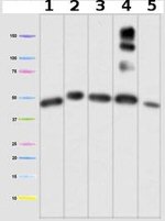 UQCRC1 Antibody in Western Blot (WB)