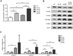 Porin Antibody in Western Blot (WB)