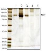 NNT Antibody in Western Blot (WB)