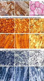 SDHA Antibody in Immunohistochemistry (IHC)