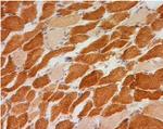 NDUFB8 Antibody in Immunohistochemistry (Frozen) (IHC (F))