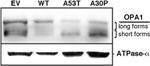 ATP5A1 Antibody in Western Blot (WB)