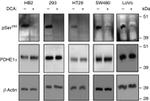 PDHA1 Antibody in Western Blot (WB)