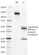c-Myb Oncoprotein Antibody in SDS-PAGE (SDS-PAGE)