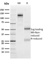 n-Myc (Neuroblastoma Marker) Antibody in SDS-PAGE (SDS-PAGE)