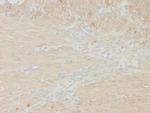 Smooth Muscle Myosin Heavy Chain (SM-MHC) (Leiomyosarcoma and Myoepithelial Cell Marker) Antibody in Immunohistochemistry (Paraffin) (IHC (P))