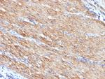 Smooth Muscle Myosin Heavy Chain (SM-MHC) Antibody in Immunohistochemistry (Paraffin) (IHC (P))
