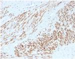 Smooth MuscleMyosin Heavy Chain (SM-MHC) (Leiomyosarcoma and Myoepithelial Cell Marker) Antibody in Immunohistochemistry (Paraffin) (IHC (P))