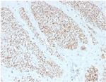 Smooth MuscleMyosin Heavy Chain (SM-MHC) (Leiomyosarcoma and Myoepithelial Cell Marker) Antibody in Immunohistochemistry (Paraffin) (IHC (P))