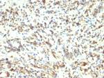 MyoD1 (Rhabdomyosarcoma Marker) Antibody in Immunohistochemistry (Paraffin) (IHC (P))