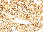 MyoD1 (Rhabdomyosarcoma Marker) Antibody in Immunohistochemistry (Paraffin) (IHC (P))