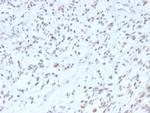 MyoD1 Antibody in Immunohistochemistry (Paraffin) (IHC (P))