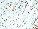 MyoD1 Antibody in Immunohistochemistry (Paraffin) (IHC (P))